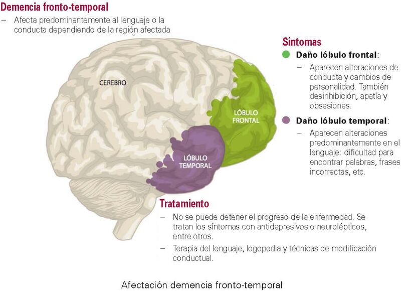 demencia frontotemporal