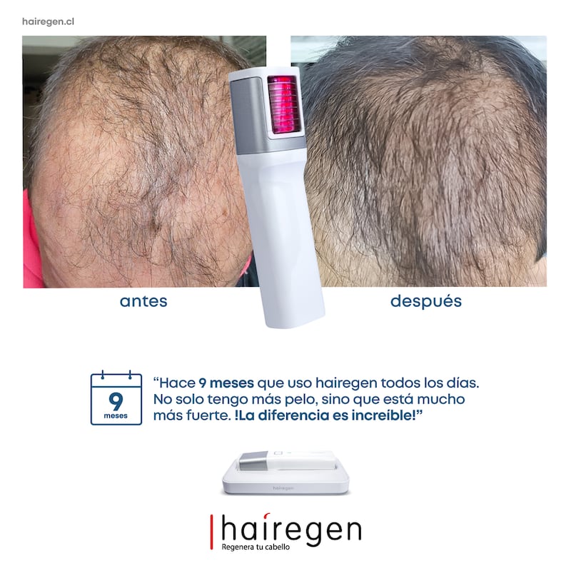 Hairegen